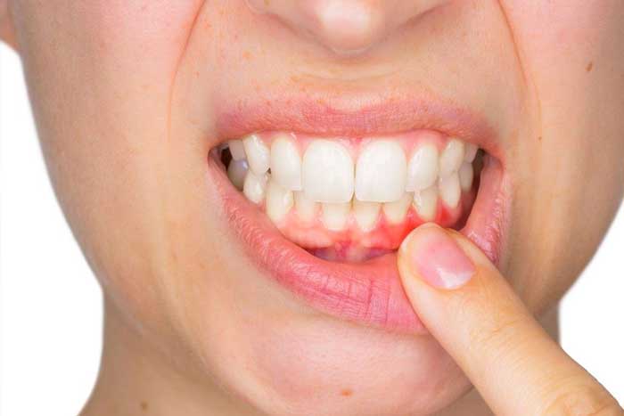 اهمیت بهداشت دهان و دندان در سالمند